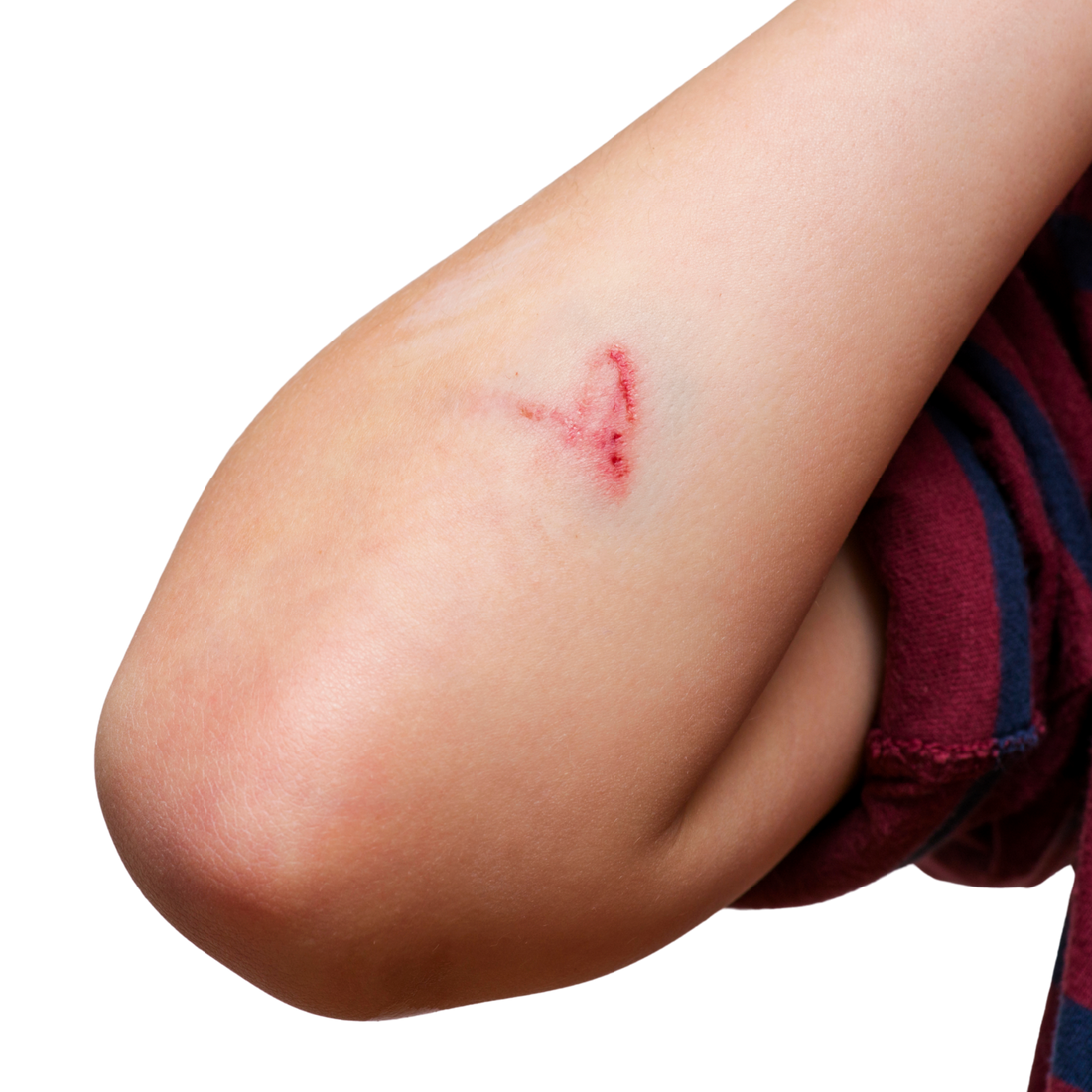 Cut on elbow