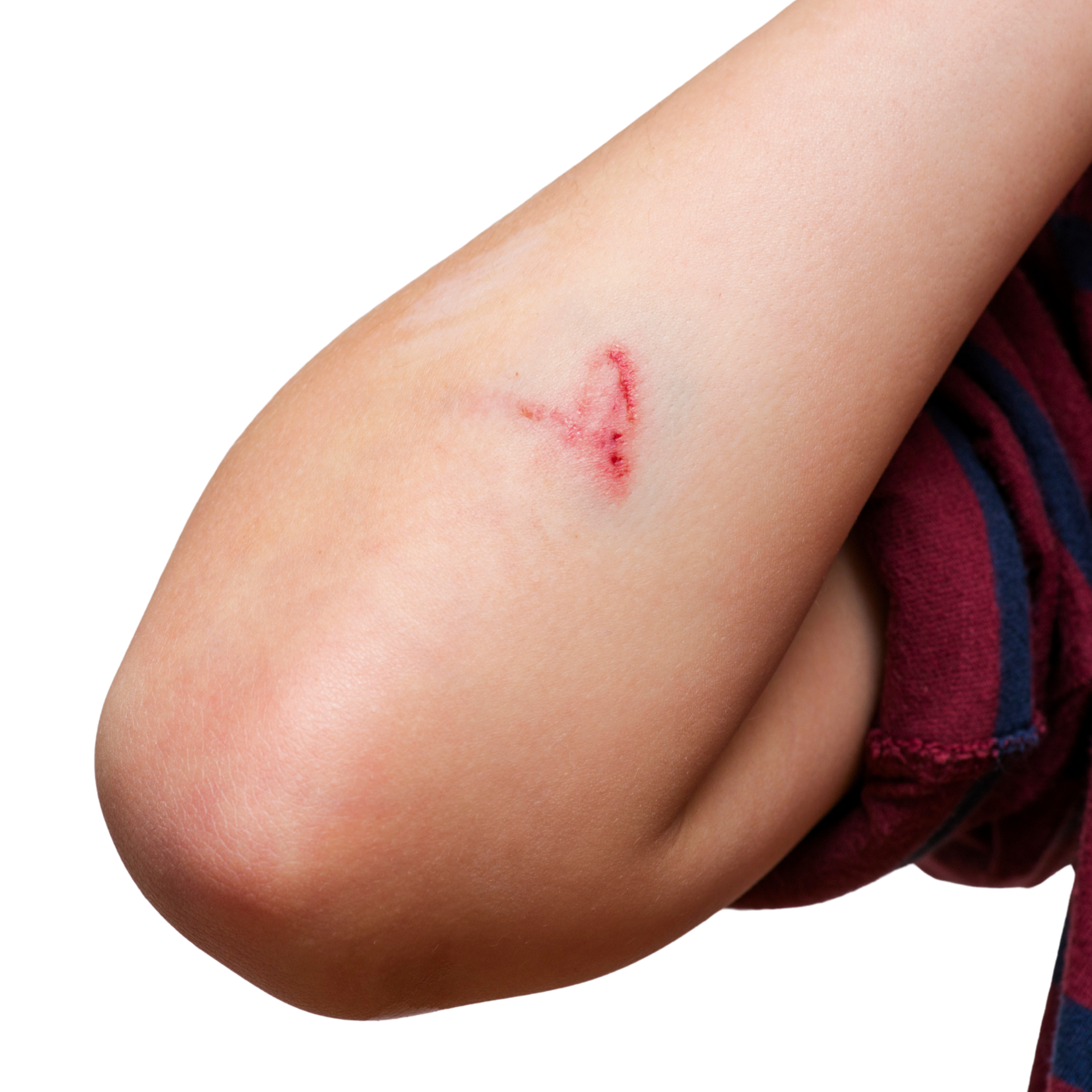 Why Is My Cut Itchy?