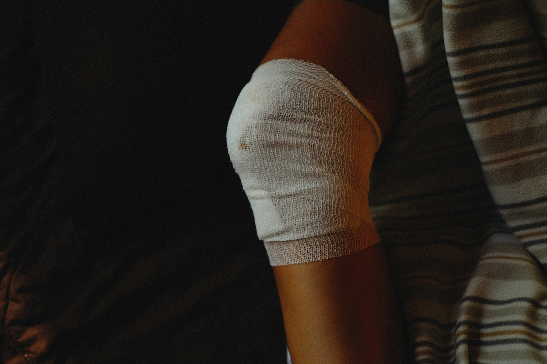 Minor burn on the knee that is bandaged as it prepares to close 