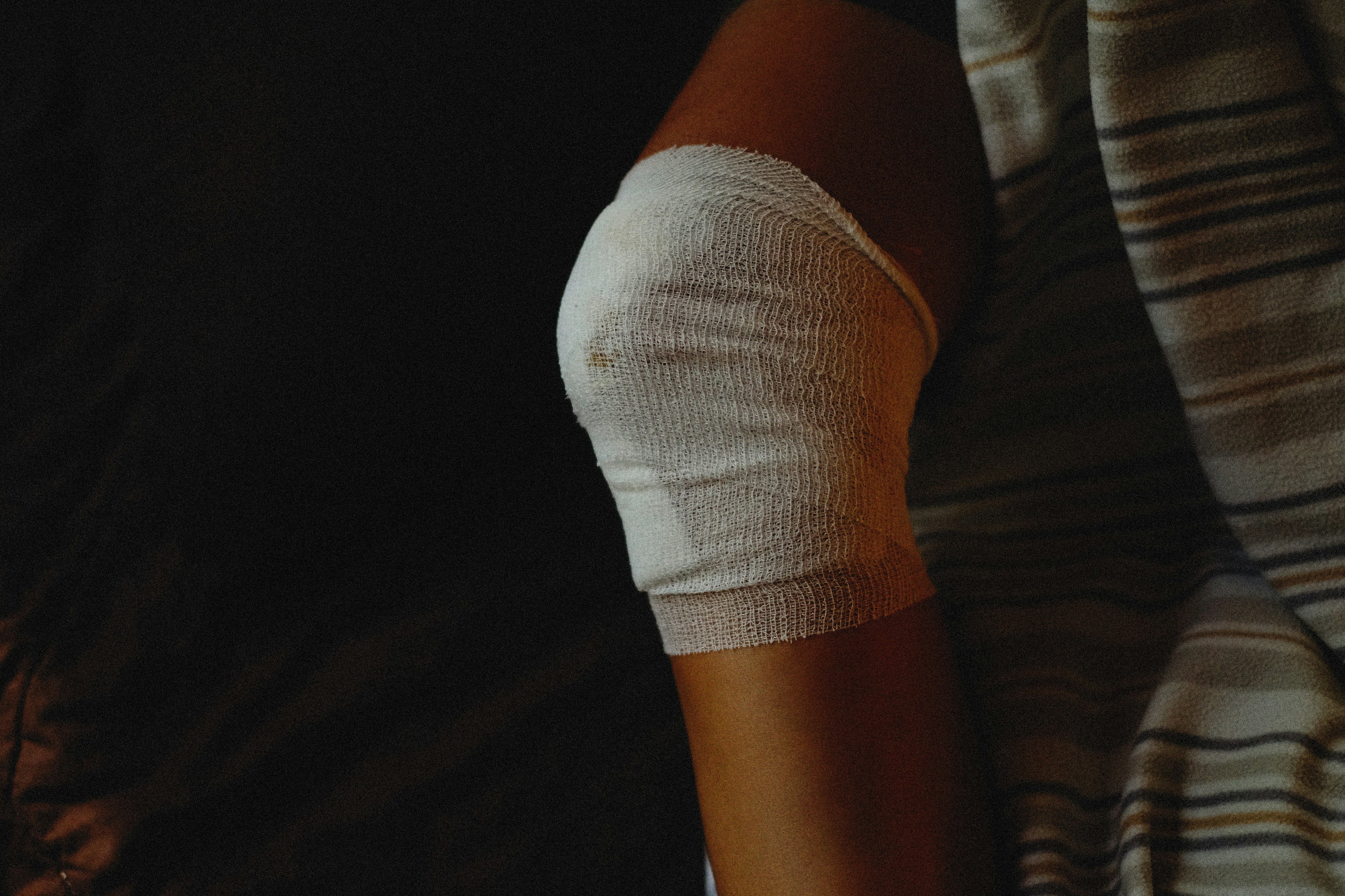 Minor burn on the knee that is bandaged as it prepares to close 