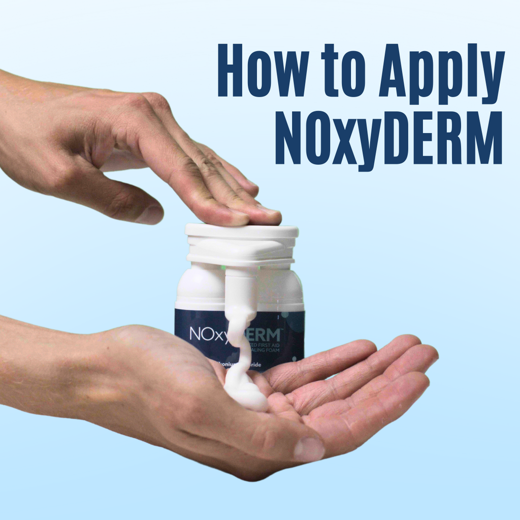 How to apply NOxyDERM wound care foam for wound recovery
