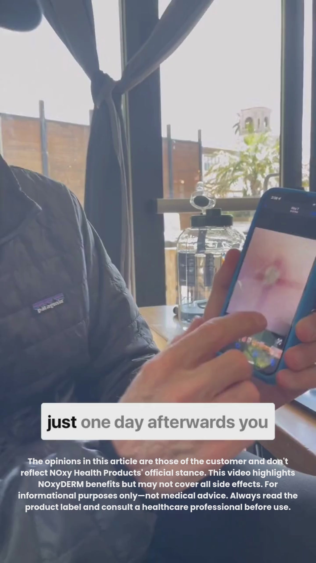 NOxyDERM Premium Wound Care Foam