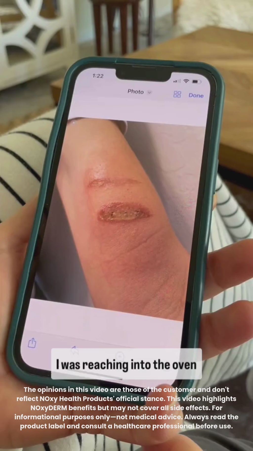 NOxyDERM Premium Wound Care Foam